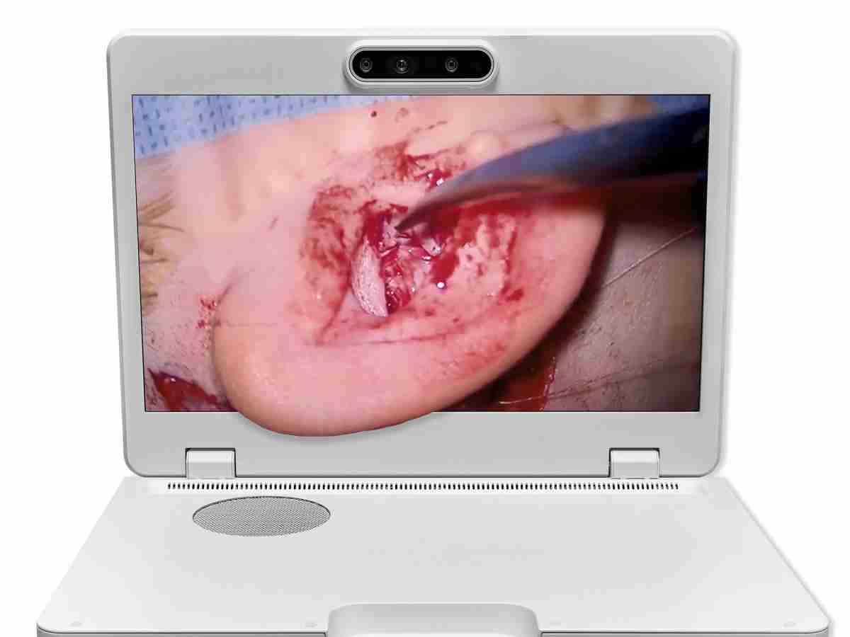 达擎之＂Heads-up 3D显微手术显示系统＂，，，，整合4K裸眼3D显示及眼球追踪系统，，具备快速追踪人眼移动位置功能，，，减轻医师长时间维持固定姿势的负担，，，让医师能有更宽广清晰的3D立体视野及更舒适的姿势来执行手术。。